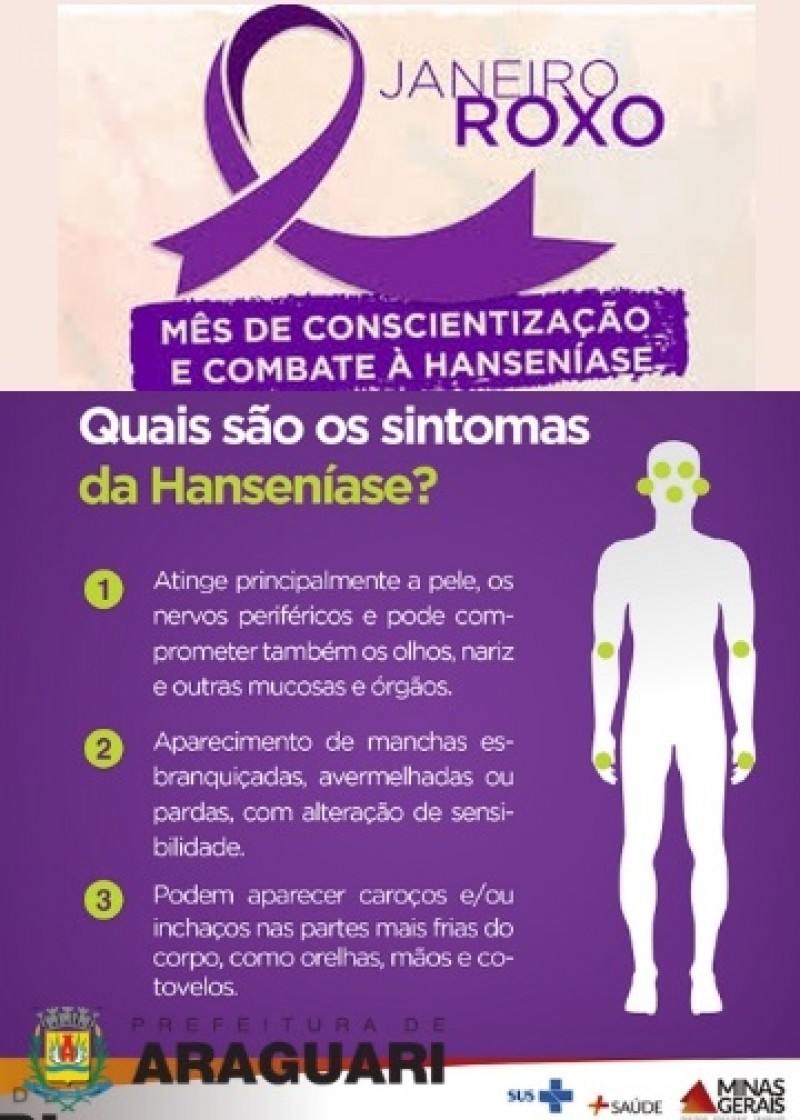 Campanha conscientiza sobre sintomas e tratamento da hanseníase -  Prefeitura de Limeira